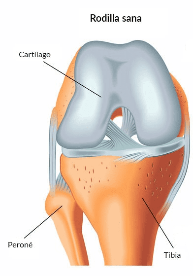 clinica_de_Reumatologia_artrosis_terapias