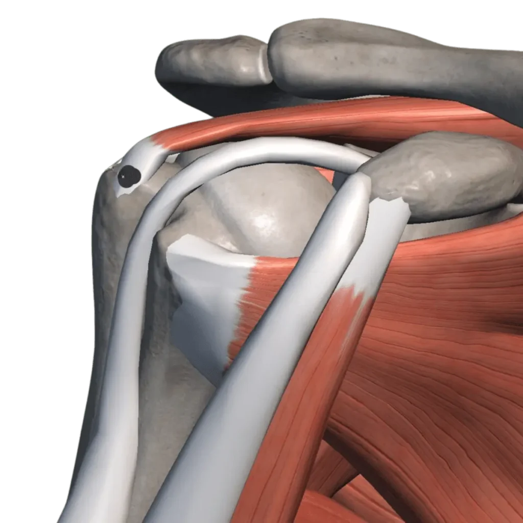 clinica_de_reumatologia_tendinitis_calcificante