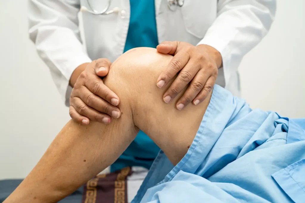Imagen de rodilla inflamada – artrosis de rodilla en etapa moderada