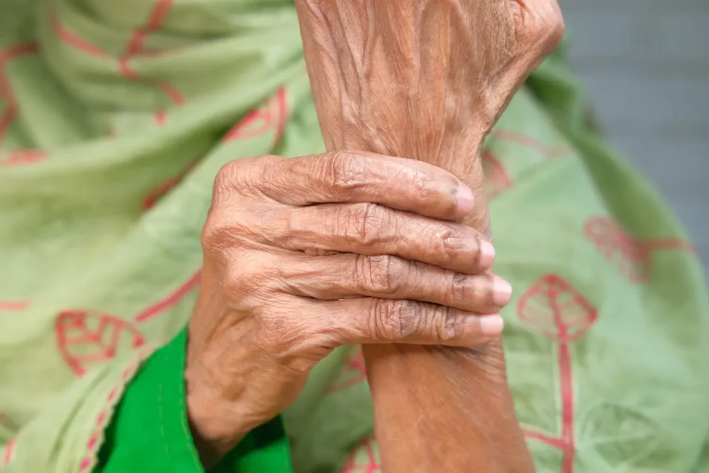 Persona adulta mayor con osteoartritis