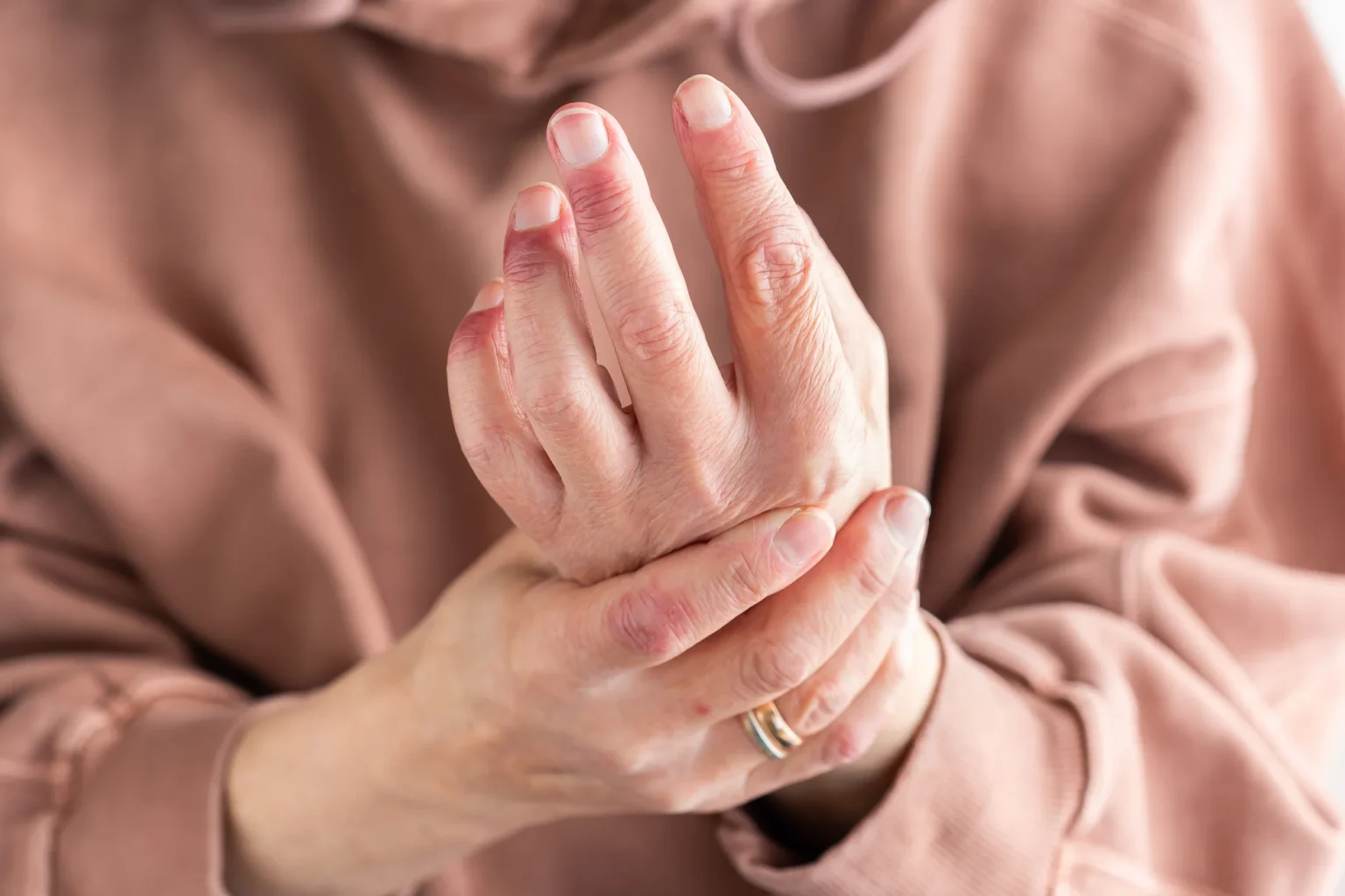 Clínica de reumatología | mano con deformidades por artrosis de manos - clinica de reumatologia